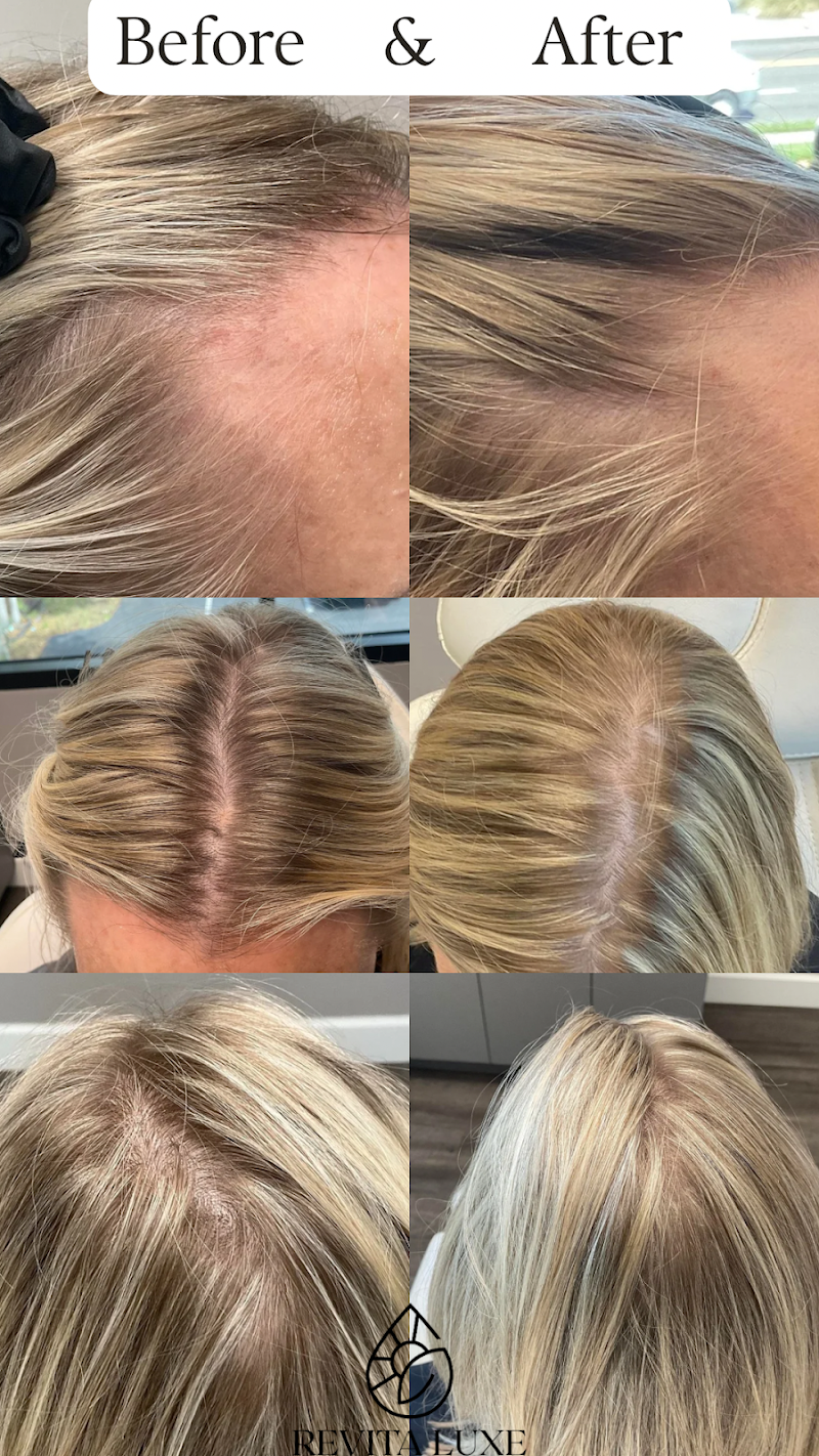 Revita Luxe - Jacksonville