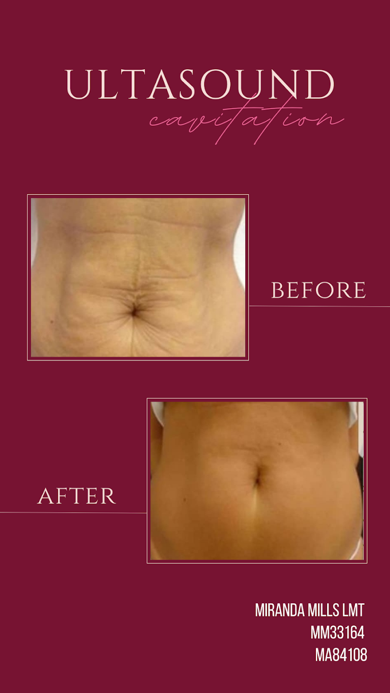Lymphatic Drainage Massage